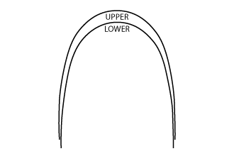 Dây cung Beta Titanium- CNA